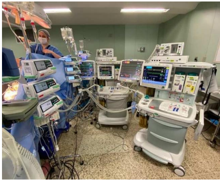 Anesthetic Management of an Omphalopagus Conjoined Twins Separation Surgery - A Case Report